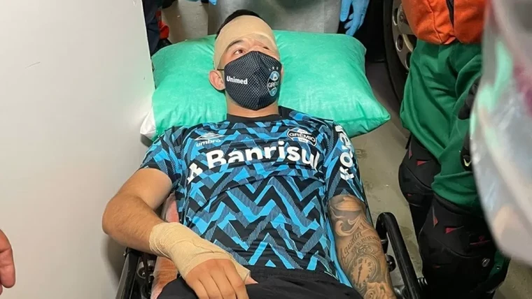 Steen door ruit spelersbus: Paraguayaans international afgevoerd naar ziekenhuis