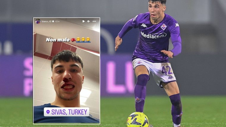 Turkse hooligan deelt dreun uit en breekt neus van Fiorentina-middenvelder