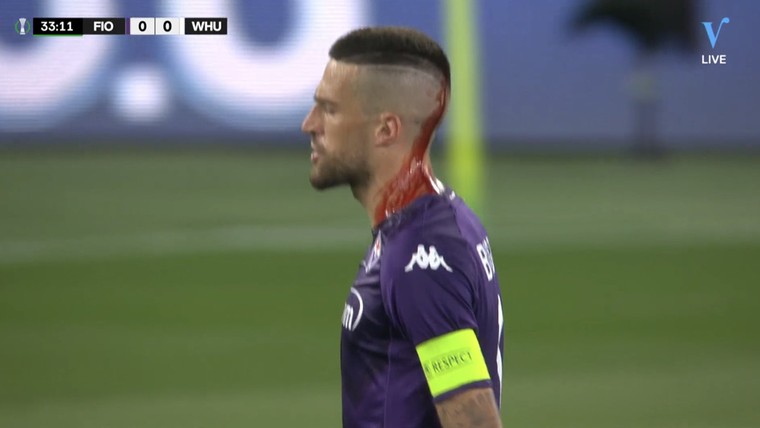 Fiorentina-captain loopt bloedende hoofdwond op na gegooid object