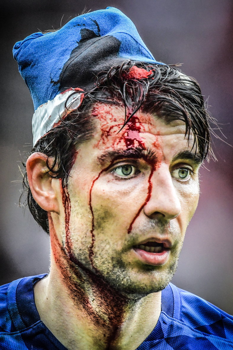 Je moet haast wel een gat in je kop hebben om te denken dat je zó mee kan doen. Schitterend hoe het bloed over het voorhoofd van Vedran Corluka langs z’n oog naar beneden stroomt.